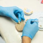 implantes dentales precio