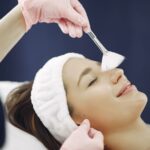 chemical peeling treatment