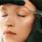eliminación tatuaje láser